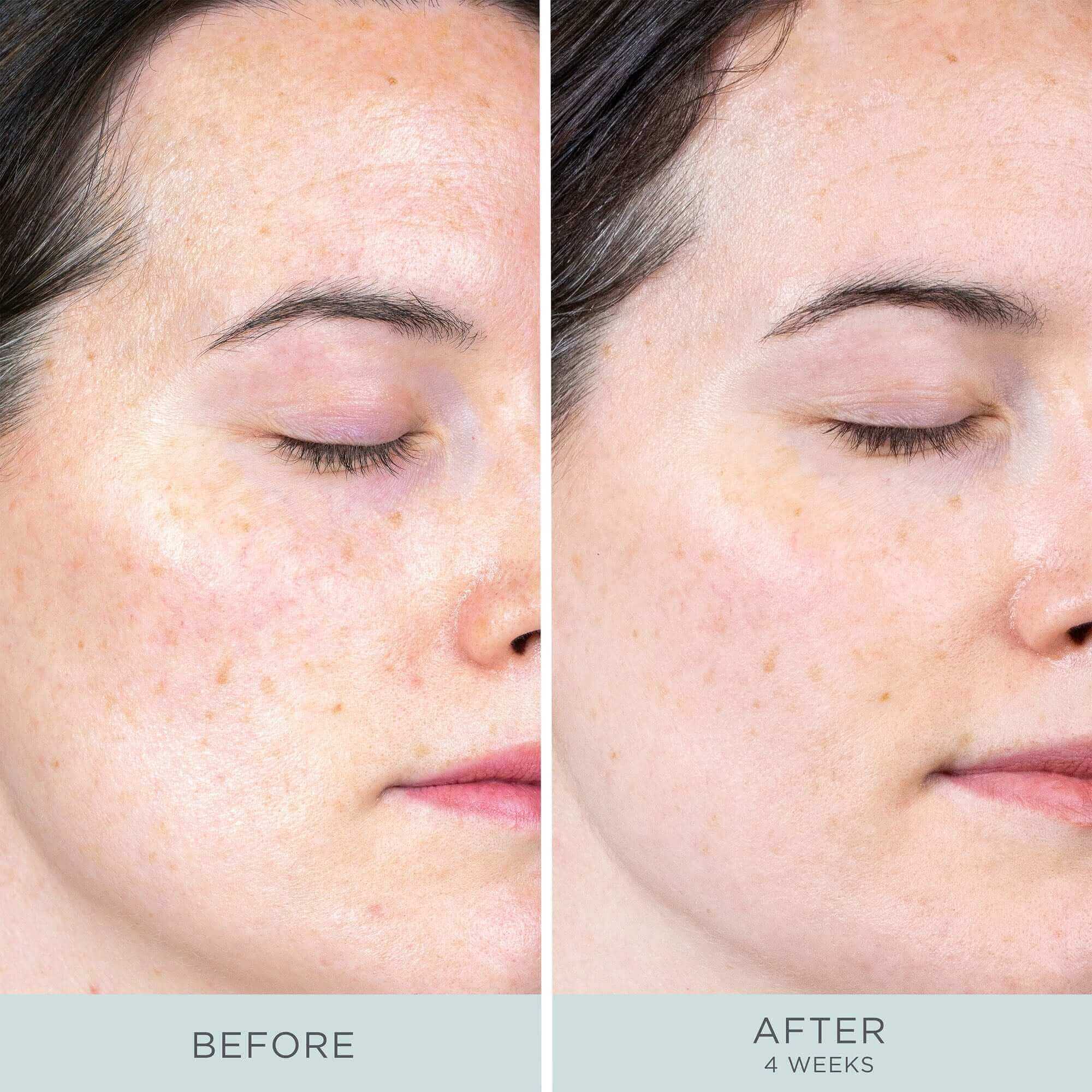 Ceretin Boost Age Defying Retinol Serum - Image 3